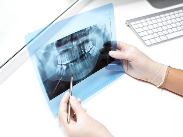 Dental X-ray